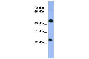 WB Suggested Anti-OPN1MW Antibody Titration: 0.