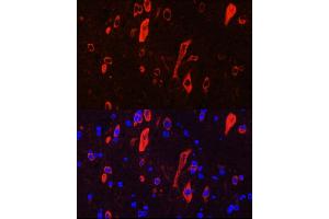Immunofluorescence analysis of rat brain cells using NTRK3 Rabbit pAb (ABIN6132429, ABIN6144910, ABIN6144912 and ABIN6221540) at dilution of 1:100 (40x lens). (NTRK3 Antikörper  (AA 40-300))
