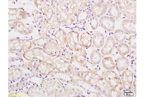 Formalin-fixed and paraffin embedded human kidney labeled with Rabbit Anti Mitofusin 2/MFN2 Polyclonal Antibody, Unconjugated (ABIN682528) at 1:200 followed by conjugation to the secondary antibody and DAB staining