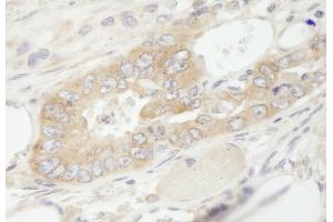 Immunohistochemistry (IHC) image for anti-Eukaryotic Translation Elongation Factor 1 gamma (EEF1G) (AA 200-250) antibody (ABIN7448955) (EEF1G Antikörper  (AA 200-250))