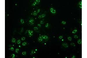 Anti-MGLL mouse monoclonal antibody (ABIN2454561) immunofluorescent staining of COS7 cells transiently transfected by pCMV6-ENTRY MGLL (RC218358). (MGLL Antikörper)