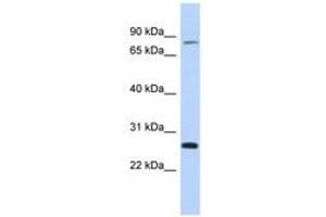 Image no. 1 for anti-Zinc Finger and SCAN Domain Containing 2 (ZSCAN2) (C-Term) antibody (ABIN6742942) (ZSCAN2 Antikörper  (C-Term))