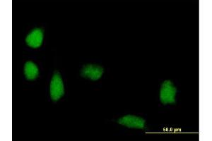 Immunofluorescence of purified MaxPab antibody to FOXP3 on HeLa cell. (FOXP3 Antikörper  (AA 1-431))