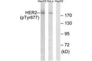 Western blot analysis of extracts from HepG2 cells and HeLa cells, using HER2 (Phospho-Tyr877) Antibody. (ErbB2/Her2 Antikörper  (pTyr877))