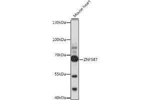 Western blot analysis of extracts of mouse heart, using ZNF587 antibody (ABIN7271507) at 1:1000 dilution. (ZNF587 Antikörper  (AA 120-240))