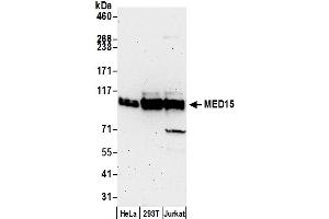 anti-Mediator Complex Subunit 15 (MED15) (AA 650-700) antibody