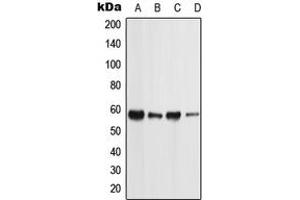 Western blot analysis of PIGW expression in MCF7 (A), NTERA2 (B), Raw264. (PIGW Antikörper  (C-Term))