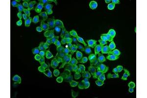 IF analysis of EIF4A1 using anti-EIF4A1 antibody (ABIN7603143).