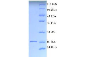 SDS-PAGE (SDS) image for Angiogenin (ANG) (AA 24-148) protein (His tag) (ABIN5712932)