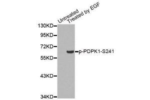 Western blot analysis of extracts from 293 cells, using Phospho-PDPK1-S241 antibody.