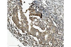 IHC analysis of Caspase-7/CASP7 using anti-Caspase-7/CASP7 antibody (ABIN7600823). (Caspase 7 Antikörper  (AA 24-303))