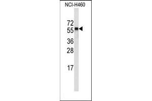 Image no. 1 for anti-Cytochrome P450, Family 4, Subfamily A, Polypeptide 11 (CYP4A11) (C-Term) antibody (ABIN360251) (CYP4A11 Antikörper  (C-Term))