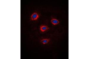 Immunofluorescent analysis of Frizzled 8 staining in Jurkat cells.