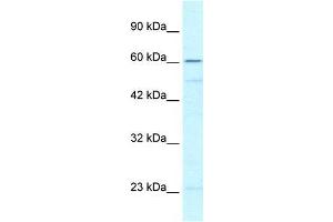 Human Jurkat; WB Suggested Anti-ZNF212 Antibody Titration: 0. (ZNF212 Antikörper  (N-Term))