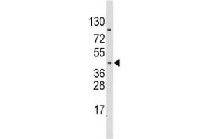 Western blot analysis of PDK4 antibody and CEM lysate (PDK4 Antikörper  (AA 250-277))