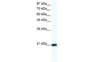 WB Suggested Anti-RAXL1 Antibody Titration:  1. (RAX2 Antikörper  (N-Term))