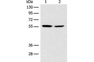 Western blot analysis of Mouse brain tissue NIH/3T3 cell lysates using CORO2B Polyclonal Antibody at dilution of 1:1000 (CORO2B Antikörper)