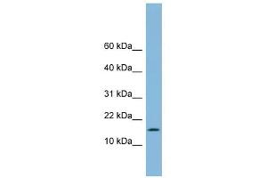 UBE2L6 antibody used at 1 ug/ml to detect target protein. (UBE2L6 Antikörper  (Middle Region))