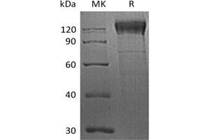 ITGB1 Protein (His tag)