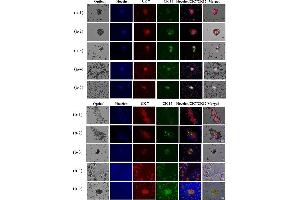 Immunofluorescence (Cultured Cells) (IF (cc)) image for anti-Keratin 17 (KRT17) antibody (ABIN2855697)