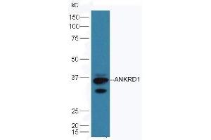 Mouse heart lysates probed with Rabbit Anti-ANKRD1 Polyclonal Antibod, Unconjugated  at 1:5000 90min in 37˚C. (ANKRD1 Antikörper  (AA 185-319))