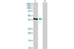 Western Blot analysis of SERTAD2 expression in transfected 293T cell line by SERTAD2 MaxPab polyclonal antibody. (SERTAD2 Antikörper  (AA 1-314))