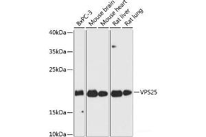 Western blot analysis of extracts of various cell lines using VPS25 Polyclonal Antibody at dilution of 1:3000. (VPS25 Antikörper)