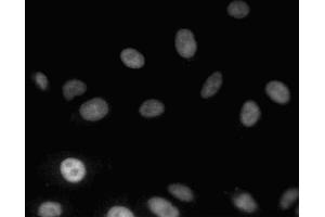 Immunofluorescent staining of A549 (ATCC CCL-185) cells. (MDM2 Antikörper  (AA 154-167))