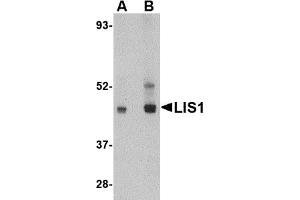 Western Blotting (WB) image for anti-Platelet-Activating Factor Acetylhydrolase 1b, Regulatory Subunit 1 (45kDa) (PAFAH1B1) (C-Term) antibody (ABIN1030486) (PAFAH1B1 Antikörper  (C-Term))