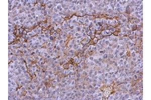 IHC-P Image Immunohistochemical analysis of paraffin-embedded PC13 xenograft, using CD41, antibody at 1:500 dilution. (Integrin Alpha2b Antikörper  (Internal Region))