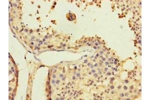 Immunohistochemistry of paraffin-embedded human testis tissue using ABIN7174348 at dilution of 1:100