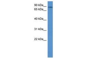 Image no. 1 for anti-Adducin 3 (Gamma) (ADD3) (C-Term) antibody (ABIN6746717) (ADD3 Antikörper  (C-Term))