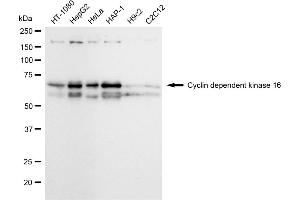 Western blotting analysis using Cyclin dependent kinase 16 antibody (ABIN7798208). (Rekombinanter CDK16 Antikörper)