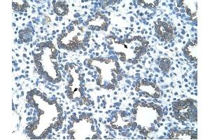 GNAS antibody was used for immunohistochemistry at a concentration of 4-8 ug/ml to stain Alveolar cells (arrows) in Human Lung. (GNAS Antikörper  (N-Term))