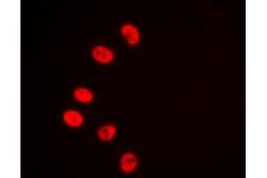Immunofluorescent analysis of NR2F2 staining in HeLa cells. (NR2F2 Antikörper  (N-Term))