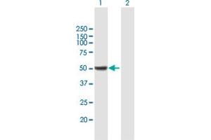 Western Blot analysis of ALDH9A1 expression in transfected 293T cell line by ALDH9A1 MaxPab polyclonal antibody. (ALDH9A1 Antikörper  (AA 1-494))