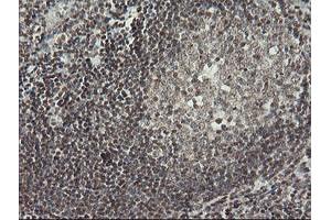 Image no. 2 for anti-Malignant T Cell Amplified Sequence 1 (MCTS1) (AA 1-181) antibody (ABIN1490598) (MCTS1 Antikörper  (AA 1-181))