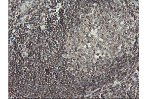 Image no. 2 for anti-Malignant T Cell Amplified Sequence 1 (MCTS1) (AA 1-181) antibody (ABIN1490598)