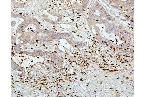 IHC analysis of PEF1 using anti-PEF1 antibody (ABIN6719632).
