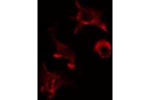 ABIN6275563 staining HuvEc cells by IF/ICC. (SH2B2 Antikörper  (N-Term))