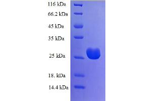 Centrosomal Protein 126 (CEP126) (AA 559-670), (partial) protein (His-SUMO Tag)