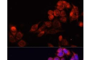 Immunofluorescence analysis of HeLa cells using SLC16A4 Polyclonal Antibody at dilution of 1:100. (SLC16A4 Antikörper)