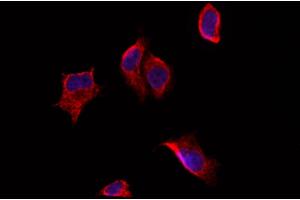ABIN6257661 and ABIN6274208 staining Hela by IF/ICC. (AKAP5 Antikörper  (N-Term))
