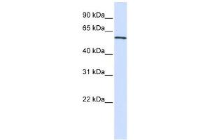 ALAS2 antibody used at 1 ug/ml to detect target protein. (ALAS2 Antikörper  (C-Term))