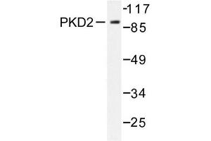 Image no. 1 for anti-Protein Kinase D2 (PKD2) antibody (ABIN272069) (PKD2 Antikörper)
