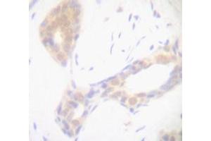 Image no. 1 for anti-Tumor Necrosis Factor alpha (TNF alpha) antibody (ABIN465674) (TNF alpha Antikörper)