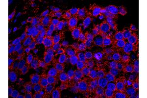 Immunofluorescence (IF) image for anti-Epidermal Growth Factor Receptor Pathway Substrate 15 (EPS15) (AA 575-625) antibody (ABIN7448961)