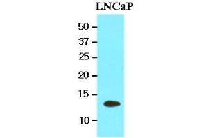 Cell lysates of LnitrocelluloseaP(20 ug) were resolved by SDS-PAGE, transferred to nitrocellulose membrane and probed with anti-human TBCA (1:1000). (TBCA Antikörper  (AA 1-108))