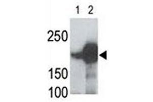 LRP5 antibody used in western blot to detect recombinant human LRP5 (Lane 1) and mouse LRP5 (2) proteins in transfected 293 cell lysate; Data is kindly provided by Drs.