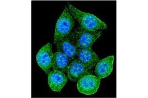 Confocal immunofluorescent analysis of RAD9A Antibody  with 293 cell followed by Alexa Fluor 488-conjugated Goat anti-Rabbit lgG (green). (RAD9A Antikörper)